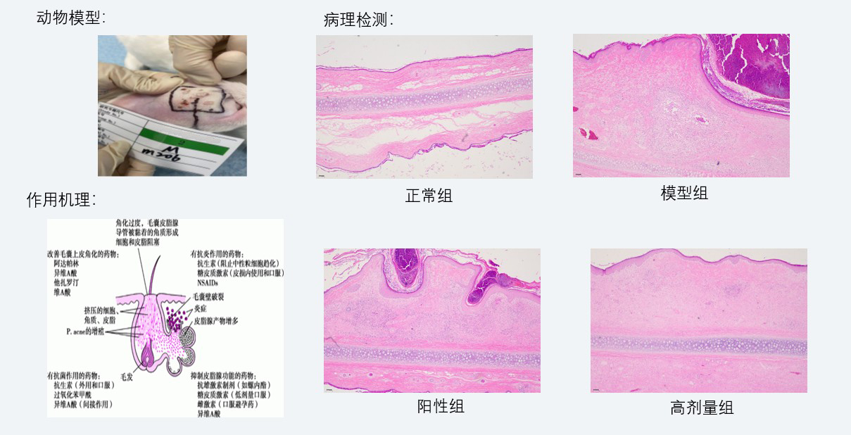 案例3：新西兰兔痤疮药效研究.jpg